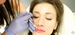 Botoks na usta: ile kosztuje i co musisz wiedzieć o powiększaniu?