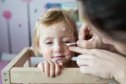 Kiedy po ospie do przedszkola? Prawda o strupkach i zakaźności