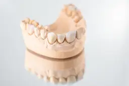 Ile kosztuje mostek na zęby? Sprawdź ceny i uniknij wysokich kosztów