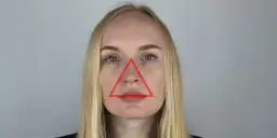 Gdzie nie wyciskać pryszczy? Unikaj tych niebezpiecznych miejsc