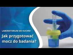 Prawidłowe pobranie moczu do badania: Klucz do trafnej diagnozy