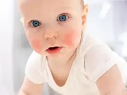 Uczulenia pokarmowe u dzieci: 7 objawów które niepokoją