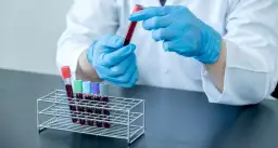 Test z kursu krwiodawstwa: Jak go zdać? Kluczowe zagadnienia