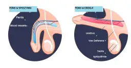 Zaburzenia erekcji objawy: Jak rozpoznać problemy z erekcją?