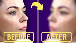 Kiedy można się malować po powiększaniu ust bez ryzyka infekcji?