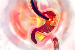 Czym są badania endoskopowe? Poznaj ich znaczenie i rodzaje