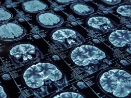 Czy fizjoterapeuta może wystawić skierowanie na rezonans? Oto prawda