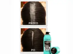 Siwe odrosty: Jak je zakryć lub stylowo zaakceptować? Poradnik