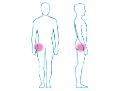 Objawy stawu biodrowego: jak rozpoznać ból i unikać problemów