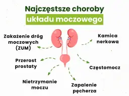 Przyczyny zapalenia pęcherza moczowego: co musisz wiedzieć, aby uniknąć problemów