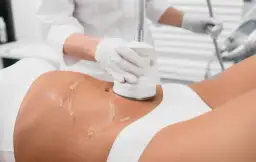 Liposukcja ultradźwiękowa: Odstęp między zabiegami klucz do sukcesu