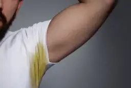 Jak usunąć plamy z dezodorantu? Skuteczne sposoby i zapobieganie