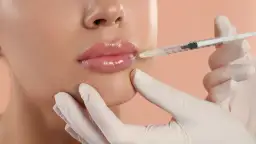 Masaż ust po kwasie hialuronowym: kiedy pomaga, a kiedy szkodzi?