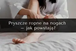 Pryszcze na nogach: przyczyny, skuteczne metody leczenia i profilaktyka