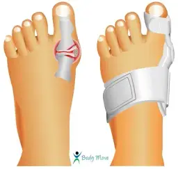 Co na haluksy do butów? Skuteczne sposoby na ból i komfort