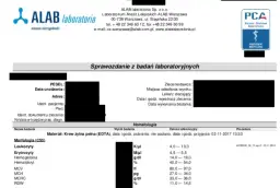 Wyniki ALAB online: Pobierz łatwo i bez stresu! Poradnik.