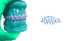 Gdzie założyć aparat na zęby, by uniknąć wysokich kosztów i bólu?