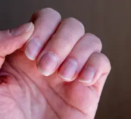 Czy paznokieć odrasta? Dowiedz się, jak długo trwa proces regrowth