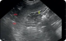 Śledziona u psa: jakie choroby jej dotyczą i jak skutecznie leczyć?