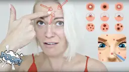 Szybkie sposoby na pryszcza: Pozbądź się go w jedną noc!