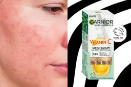 Co daje serum z witaminą C? Rozjaśnij przebarwienia, ujędrnij skórę!