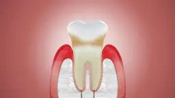 Uszkodzone dziąsła nie odrastają? Poznaj skuteczne metody leczenia