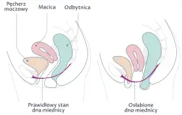 Jakie ćwiczenia na odbyt pomogą wzmocnić mięśnie i poprawić zdrowie