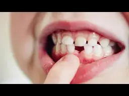 Czy zęby stałe rosną z wiekiem? Odkryj, co się z nimi dzieje