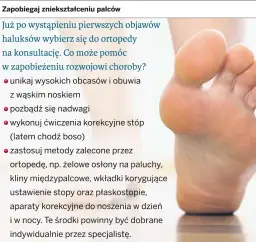 Jak wyleczyć haluksy? Pełny przewodnik: metody, koszty, rekonwalescencja