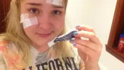 Maść ichtiolowa na pryszcze: Jak stosować? Skuteczny sposób