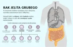 Rak jelita grubego objawy forum - co musisz wiedzieć, aby nie przegapić sygnałów
