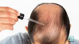 Sekret skuteczności: jak często stosować wcierki do włosów?