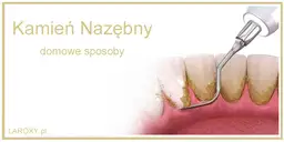 Jak usunąć kamień nazębny? Domowe mity i bezpieczne rozwiązania