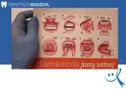 Rak dziąseł: objawy. Czy Twoje dziąsła mówią Ci coś ważnego?