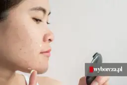 Pasta do zębów na pryszcze: Mit, który szkodzi. Co działa naprawdę?