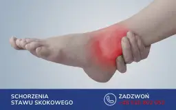 Ból kostki z zaczerwienieniem sugeruje nieleczone złamanie kostki. Skontaktuj się z nami, aby uzyskać pomoc.