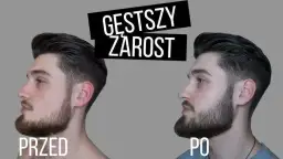 Gęsty zarost na twarzy? Skuteczne metody i porady eksperta!