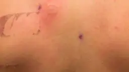 Jak rozpoznać nikiel w kosmetykach i uniknąć alergii – oznaczenia INCI