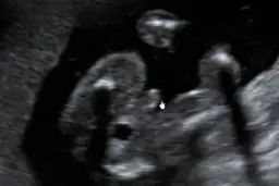 Czy w 16 tygodniu ciąży naprawdę widać płeć dziecka? Sprawdź, co mówią badania USG