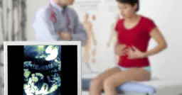 Zrosty po operacji objawy – jak je rozpoznać i co robić?