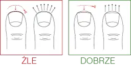 Czym obcinać paznokcie, aby uniknąć wrastania i bólu?