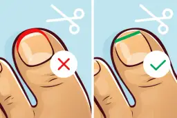 Jak bezpiecznie obcinać dziecku paznokcie u nóg - porady dla rodziców