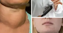 Niedobór jodu: Nie zgaduj! Jak go sprawdzić naprawdę?