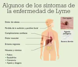 Síntomas de Lyme: Identifica los signos tempranos y evita complicaciones