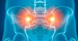 Objawy bólu stawu krzyżowo-biodrowego, które musisz znać. Skuteczne sposoby leczenia