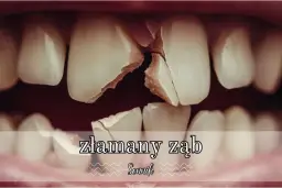 Znaczenie złamanego zęba w senniku - Co przepowiada ten niepokojący sen