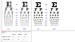 Jak widzi się z wadą wzroku? Zrozumienie codziennych trudności