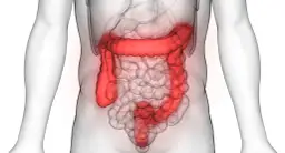 Jelito grubego choroby objawy: Jakie są objawy chorób jelita grubego?