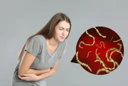 Pasożyty jelitowe: 6 sygnałów, że je masz. Skuteczne leczenie