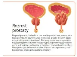 Skutki uboczne leków na prostatę: jak unikać zagrożeń i monitorować zdrowie